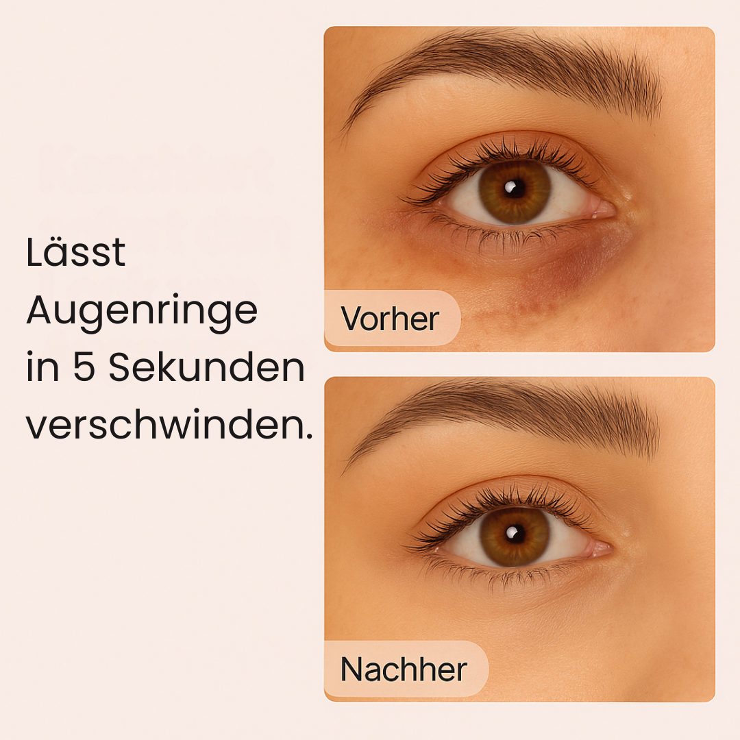 Élan d’Or - Premium Augenringaufheller